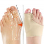 Correcteur orthopédique hallux valgus